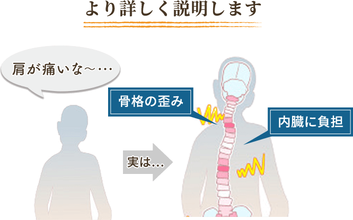 より詳しく説明します